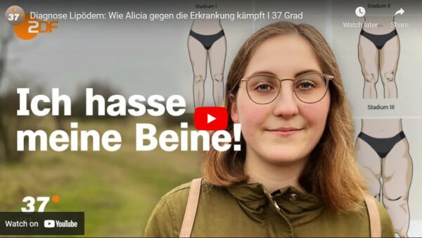 ZDF-Doku: Diagnose Lipödem - Wie Alicia gegen die Erkrankung kämpft | 37 Grad